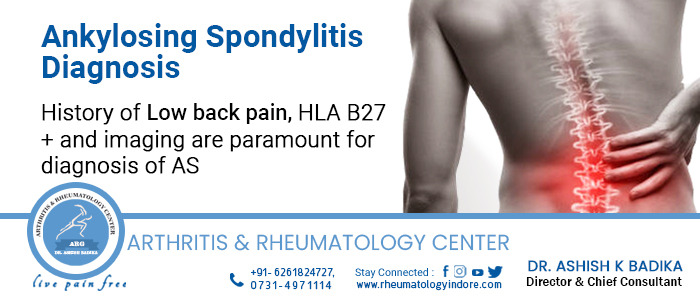 Ankylosing Spondylitis Diagnosis - Dr. Ashish Badika, rheumatologyindore.com