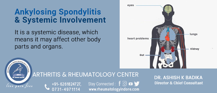 Ankylosing Spondylitis & Systemic Involvement - Dr. Ashish Badika