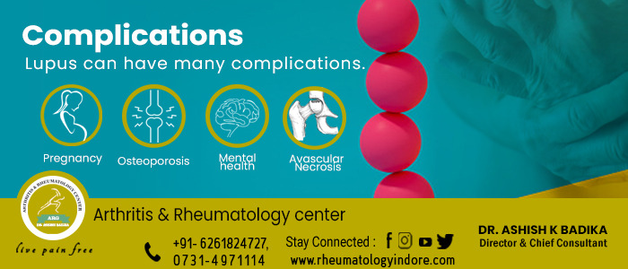 Systemic Lupus Erythematosus (SLE) / Lupus Complications - Dr. Ashish Badika