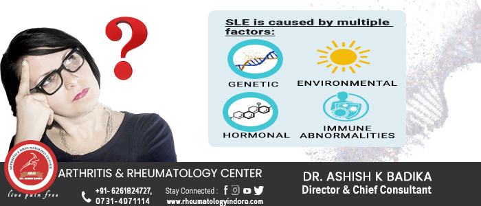 Systemic Lupus Erythematosus (SLE)/Lupus- Etiology Causes, SLE Cause