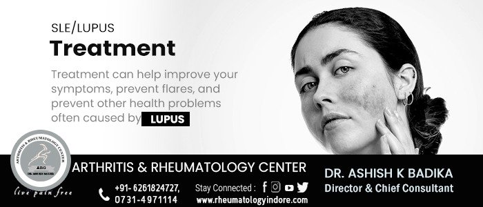 Systemic Lupus Erythematosus (SLE)/Lupus Treatment - Dr. Ashish Badika
