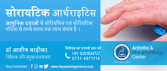 सोरियाटिक अर्थराइटिस का इलाज इंदौर में | Psoriatic Arthritis Treatment in Indore