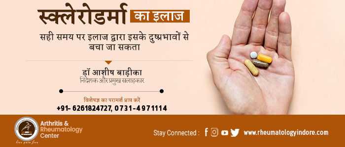 स्क्लेरोडर्मा इलाज, Scleroderma Treatment in Hindi - डॉ. आशीष बाड़ीका