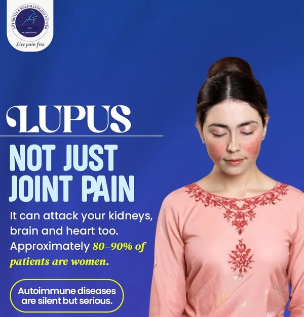 Systemic Lupus Erythematosus (SLE) Treatment in Indore, systemic lupus treatment in Indore, SLE specialist in Indore